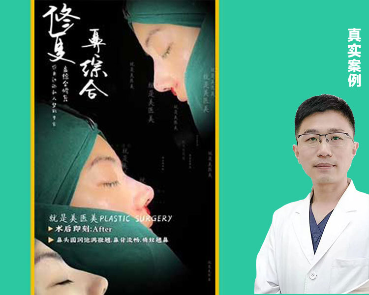 张亚伦医生-鼻综合修复案例