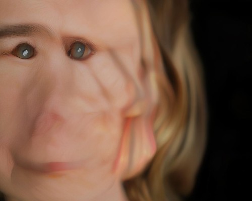 Comprehensive nasal plastic surgery-the art of creating a perfect nose shape